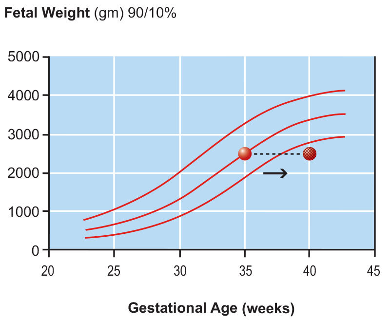 Fetal Growth Chart Two