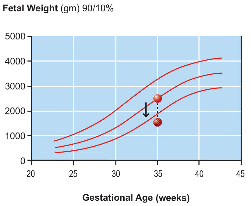 Fetal Growth Chart Three