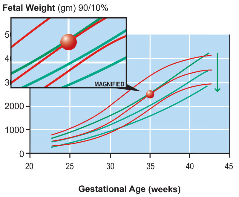 Fetal Growth Chart Four