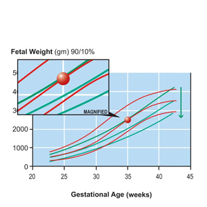 Identifying Discrepancies in Fetal Weight Growth Charts